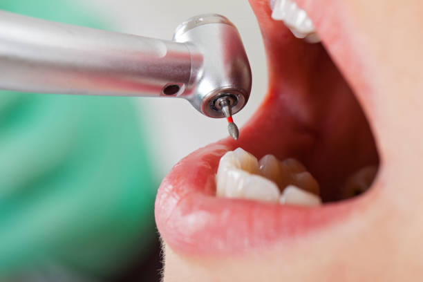 Best Knocked-Out Tooth Emergency  in Niwot, CO